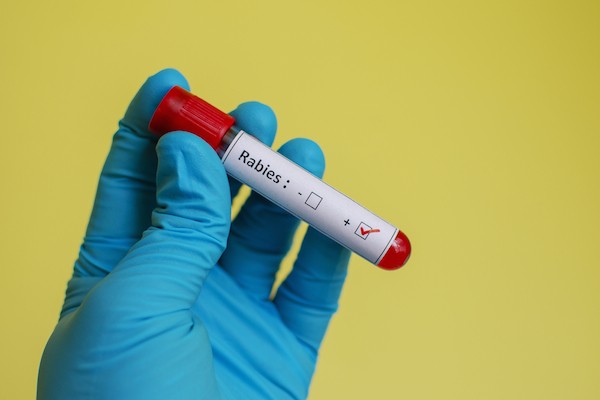 Positive rabies test by Shutterstock.