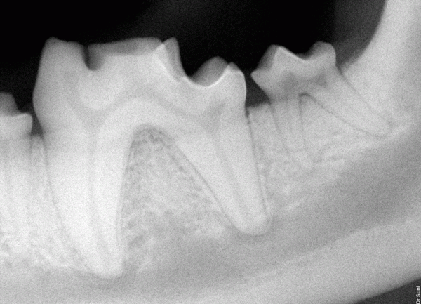 Jäger's broken tooth.