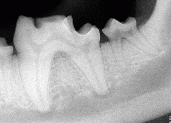 Jaeger's broken tooth.