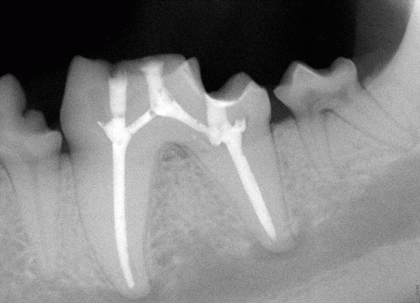 Jagers-Tooth-All-Fixed