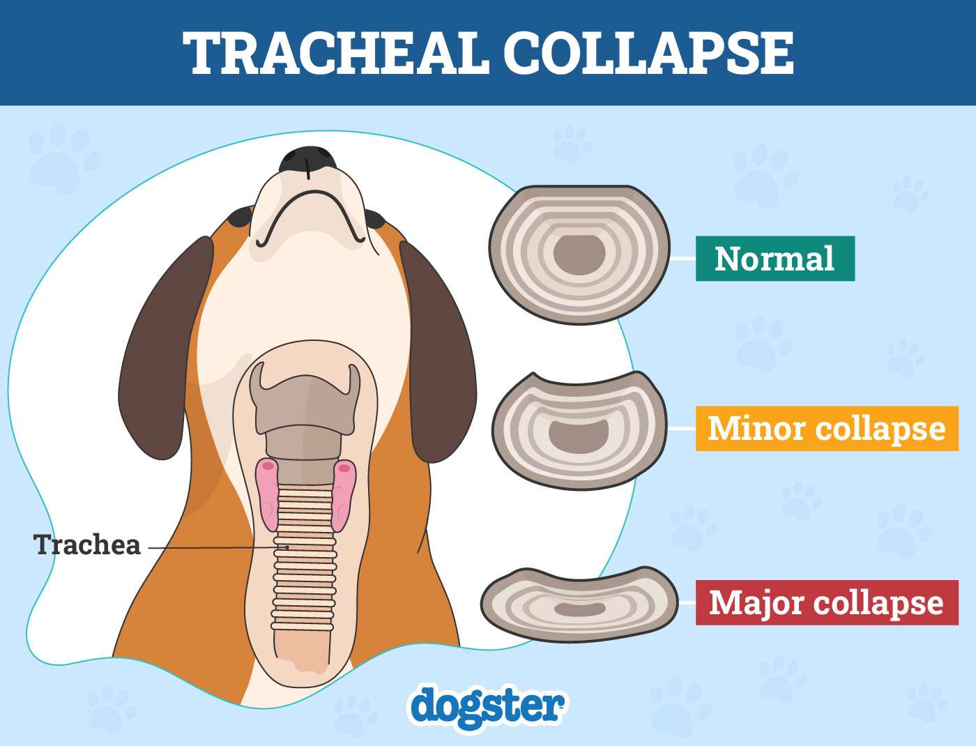 Tracheal Collapse