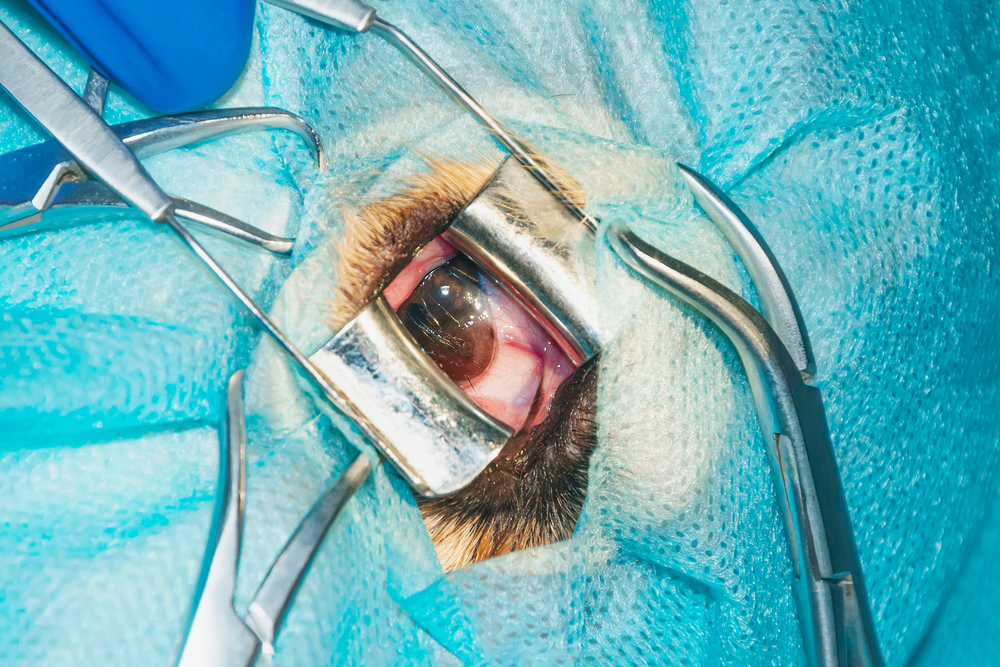 multiple-dermatoid-cysts-on-cornea