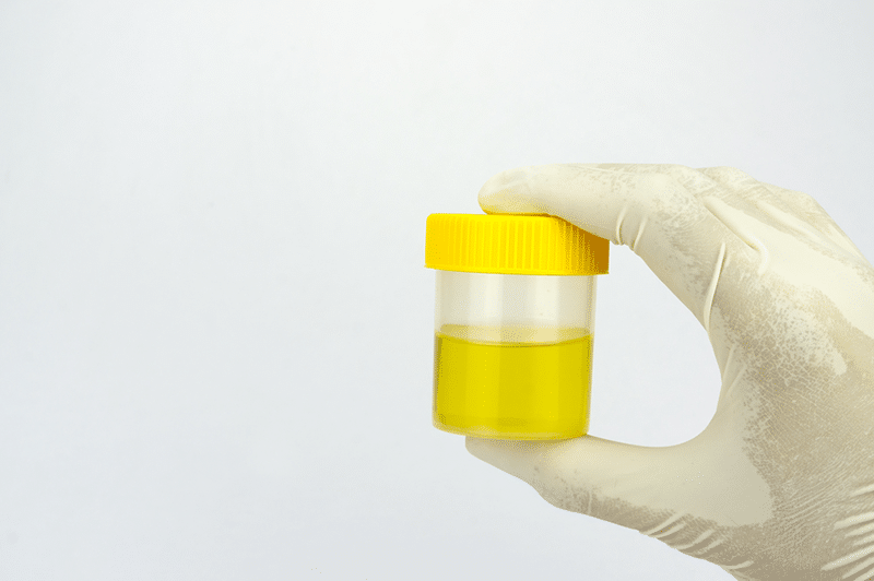 Urine sample bottle