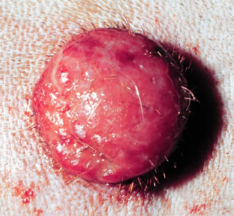 Canine histiocytoma