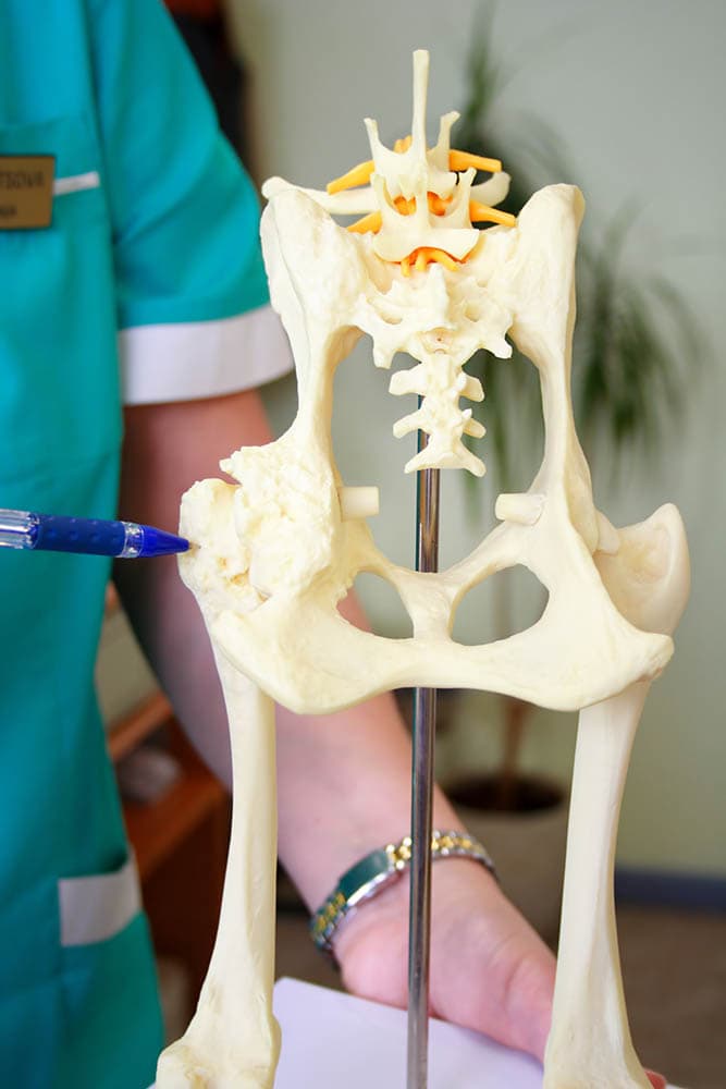 Hip dysplasia model of a dog