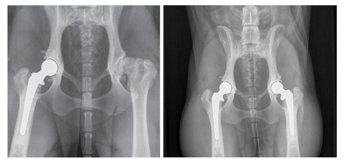 Bailey's bionic hips seen in X-ray