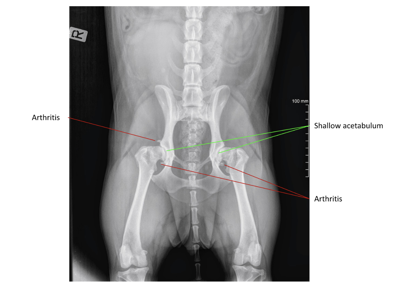 Bailey's x-ray from before surgery