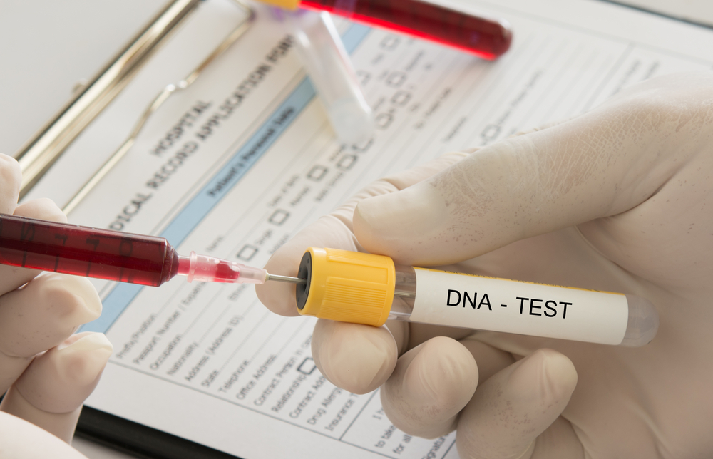doctor uses a syringe blood sample into dna test tube in the laboratory